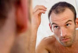 best hair loss treatment