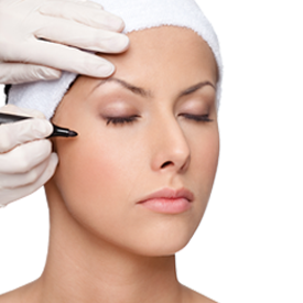 Blepharoplasty