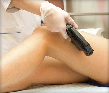 Orlando Laser Hair Removal